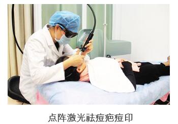 治疗痘印