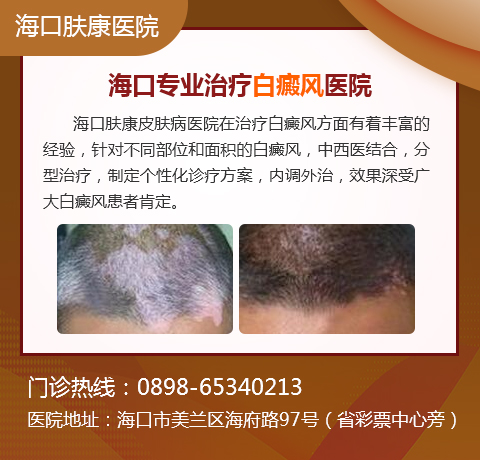 ,海口什么医院有治疗白斑的方法
