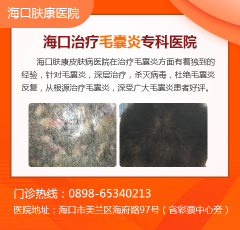 海口专业治疗毛囊炎医院