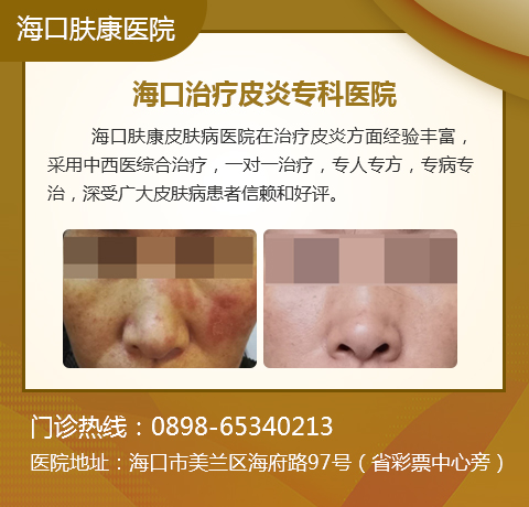 海口专科皮肤病医院